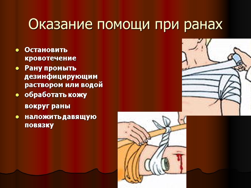 Оказание помощи при ранах  Остановить кровотечение Рану промыть дезинфицирующим раствором или водой обработать